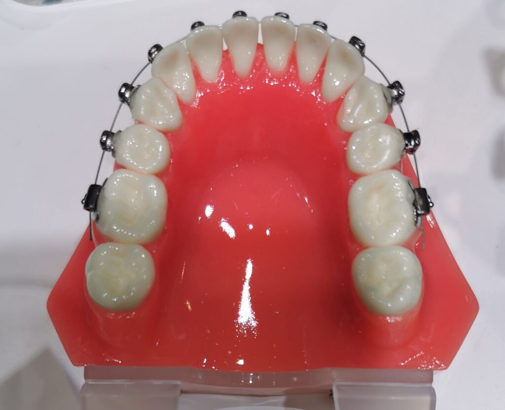 3D医疗打印